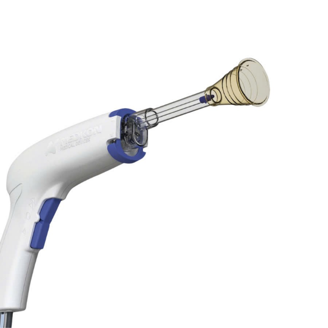 Battery-powered Disposable Surgical/Orthopaedic Pulse Lavage System