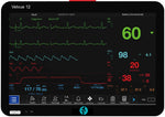 Vitavue 12 Multi-Parameter Veterinary Monitor