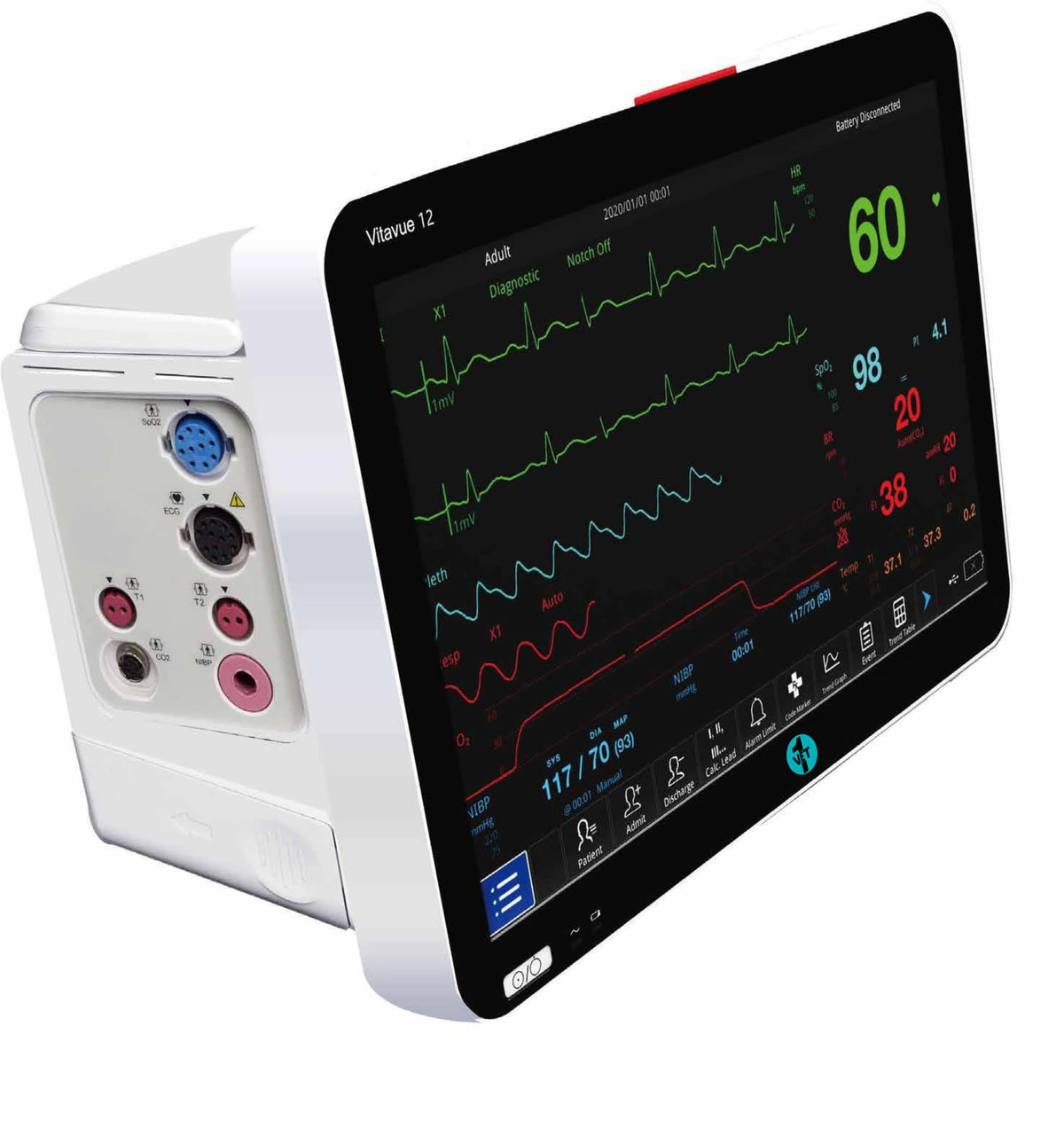 Vitavue 12 Multi-Parameter Veterinary Monitor